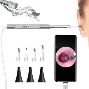 Anykit HD Otoscope Camera w/ Ear Wax Removal Tool for $27 Anykit HD Otoscope Camera w/ Ear Wax Removal Tool for $27