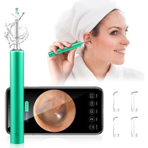 Mosproxx Wireless Ear Wax Removal WiFi Viewable Endoscope for $16 Mosproxx Wireless Ear Wax Removal WiFi Viewable Endoscope for $16