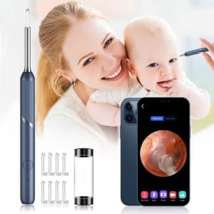 Heatoo Ear Wax Removal Endoscope with Camera for $15 Heatoo Ear Wax Removal Endoscope with Camera for $15