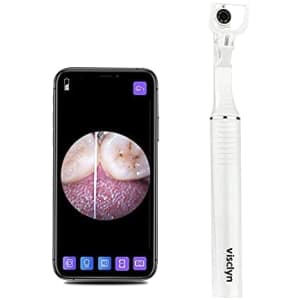 Visclyn Smart Dental Floss Visual Toothpick with Camera for $24