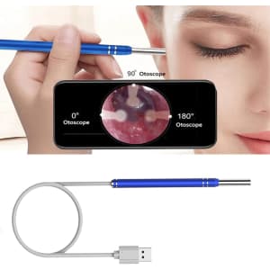 Ghjall WiFi Ear Wax Removal Tool with Camera for $10 Ghjall WiFi Ear Wax Removal Tool with Camera for $10